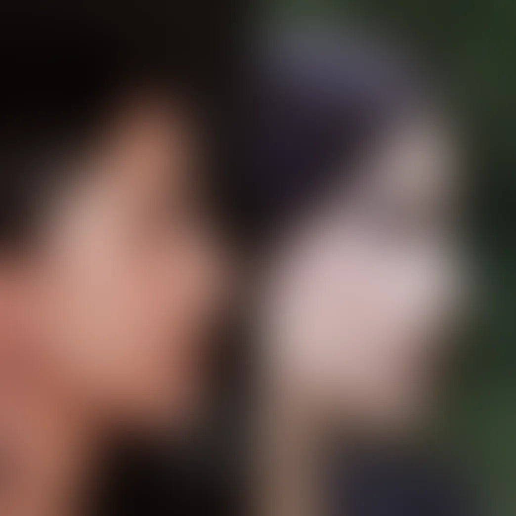 rhinoplasty_ba_blurred_1
